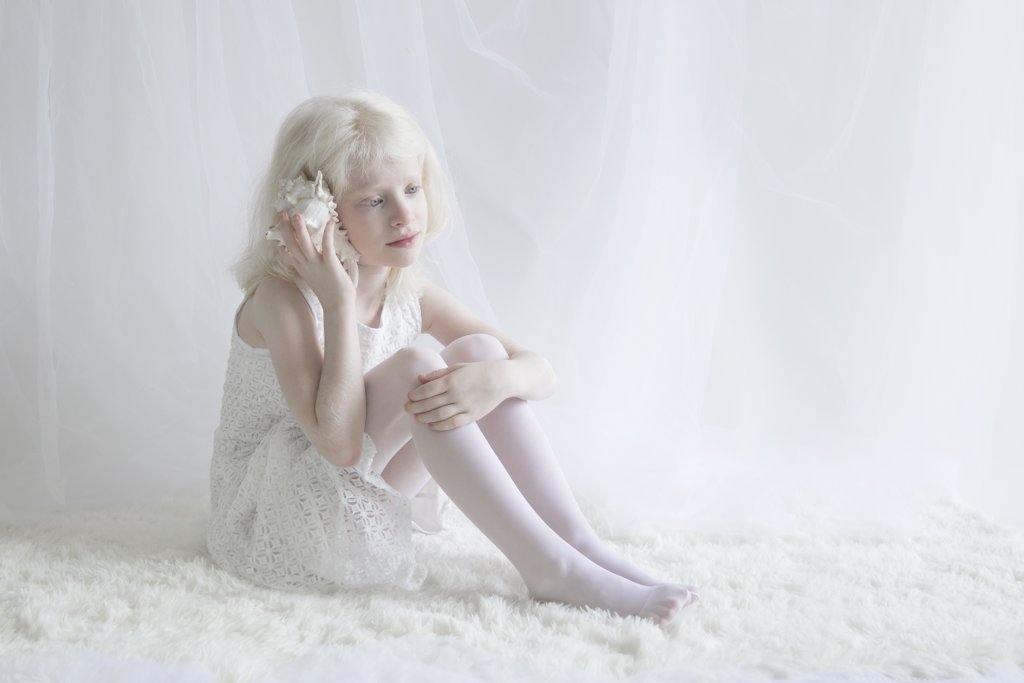 Светлые люди: фотограф показал, как красивы люди с альбинизмом