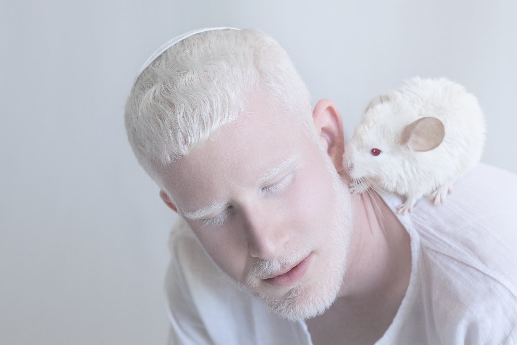 Светлые люди: фотограф показал, как красивы люди с альбинизмом