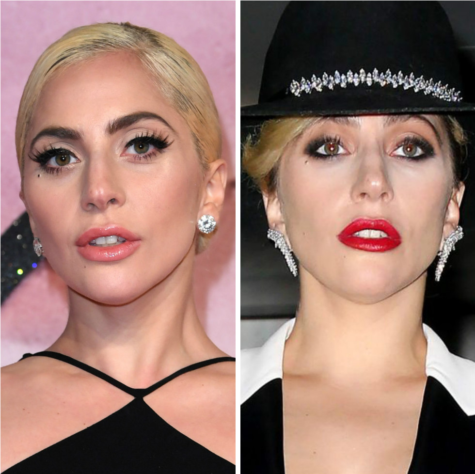 Теряются в догадках: фанаты решили, что Леди Гага сделала пластическую операцию