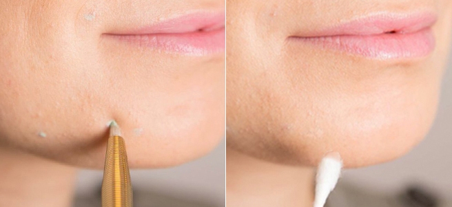 Делаем это правильно: новые способы использовать консилер