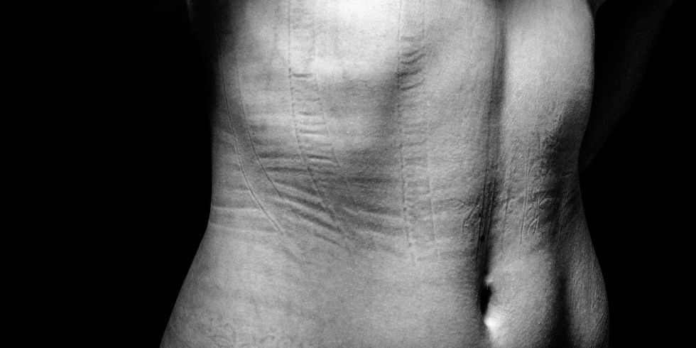 Уникальный проект: на что идут девушки ради красоты